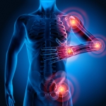 How Orthobiologics Can Help Osteoarthritis